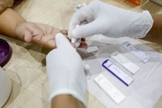 O teste rápido é oferecido gratuitamente pelo SUS nas unidades de saúde - Foto: Divulgação