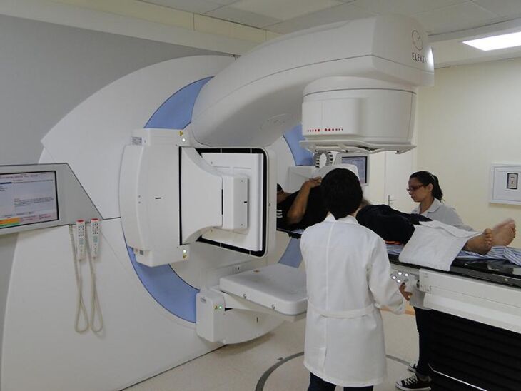 Radioterapia no HSVP